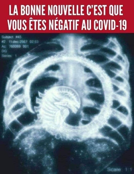 Blague   la bonne nouvelle c'est que vous êtes négatif au covid 19   alien à l'intérieur