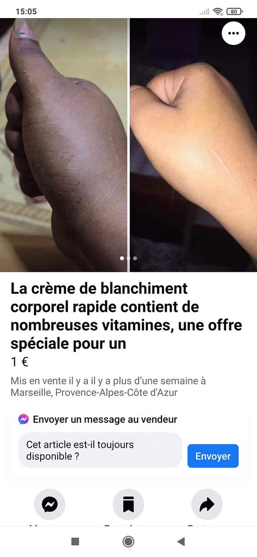 Blague   Technologie   crème de blanchiment pour rendre la peau noir en peau blanche