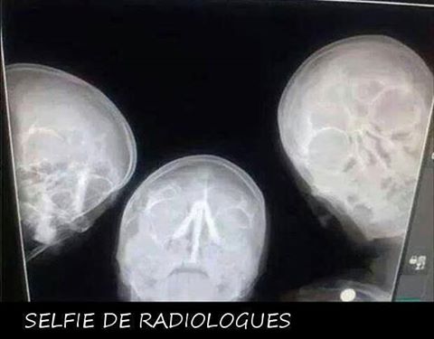 Humour   Selfie de radiologue