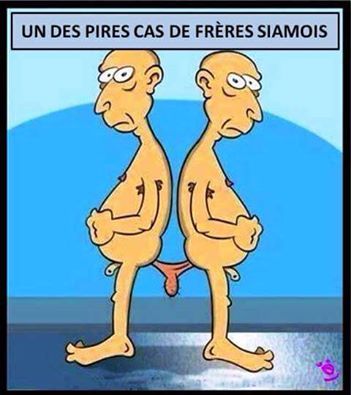 Humour   caricature    l'un des pires cas siamois