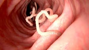 Parasite le tenia = le ver solitaire   quand on mange de la viande de porc ou de cochon cru = non cuite apèrs que le smouches on pondu leur oeuf dans la viande morte çà s'accroche aux instestins et ça mange tout 2